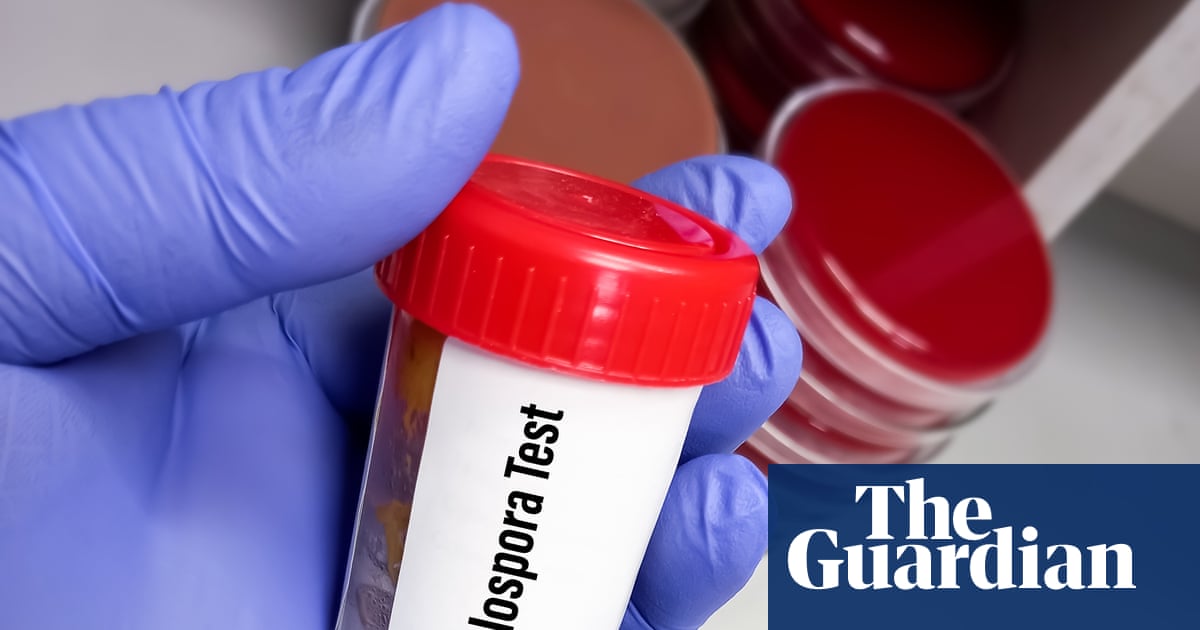 Trump’s deep public health cuts hinder response to record US cyclosporiasis outbreak