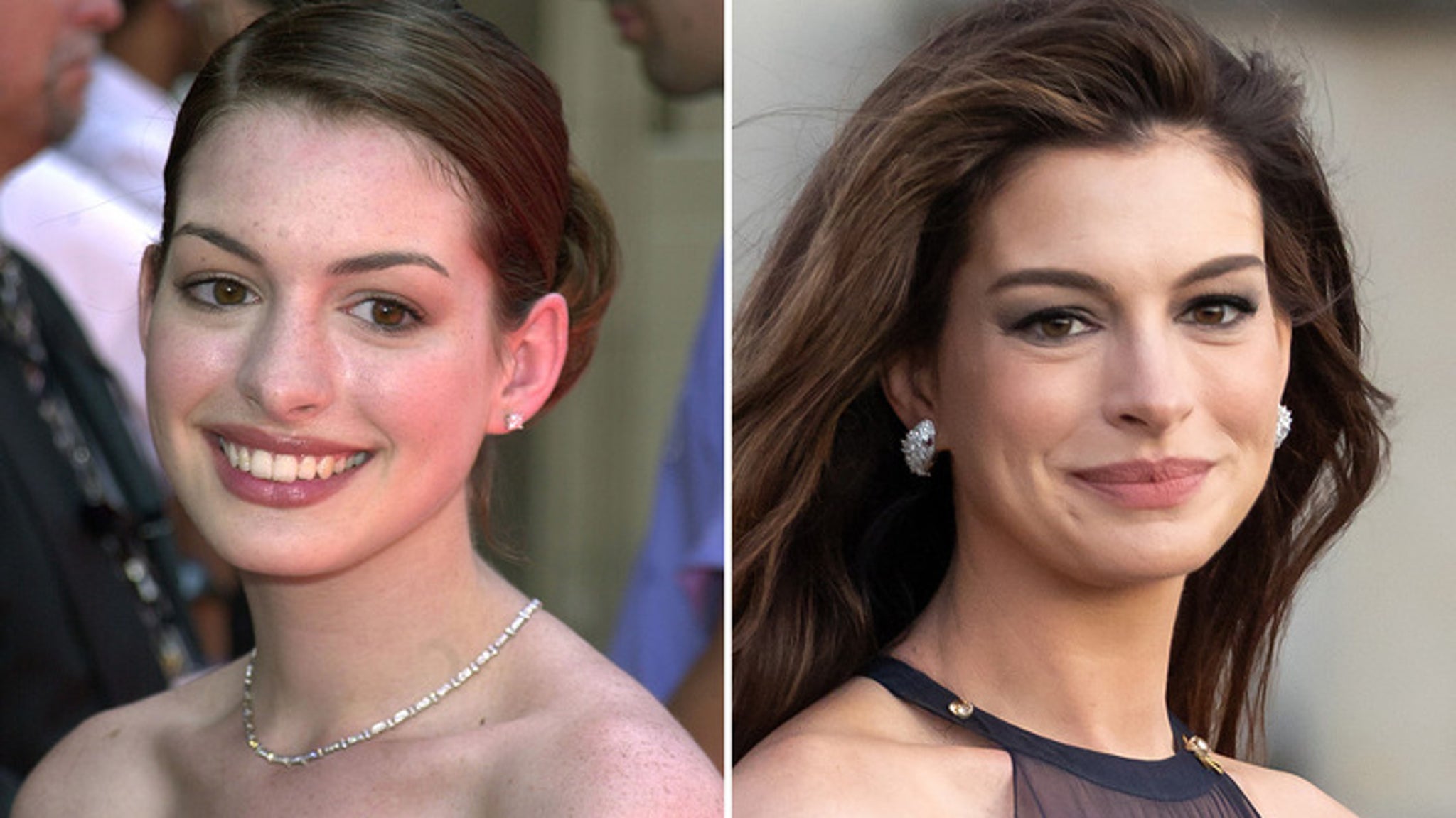Anne Hathaway Then & Now -- Good Genes or Good Docs, Hot Shots