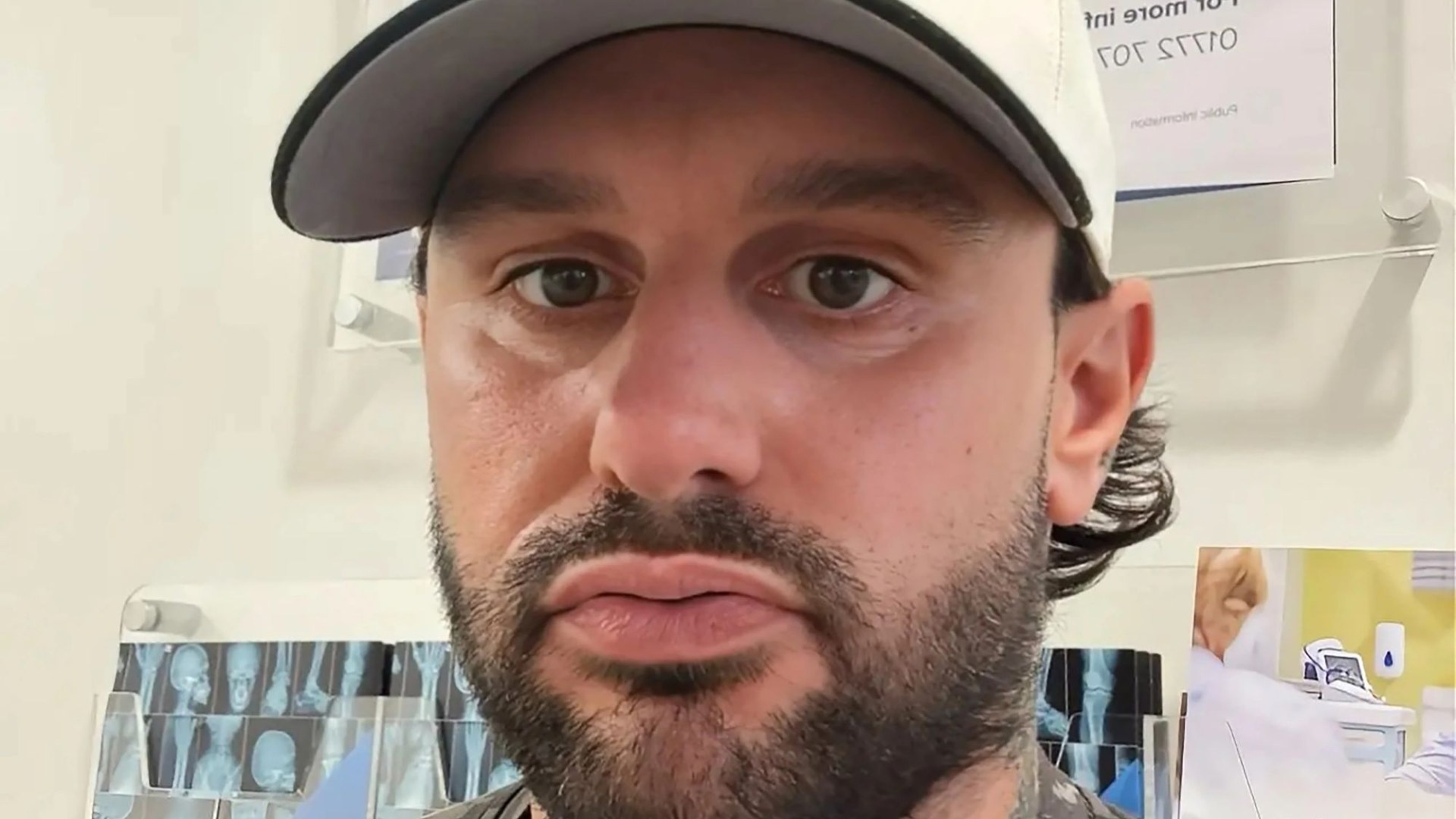 Love Triangle star reveals health problem is a ‘living hell’ after convincing himself he has muscle wasting disease
