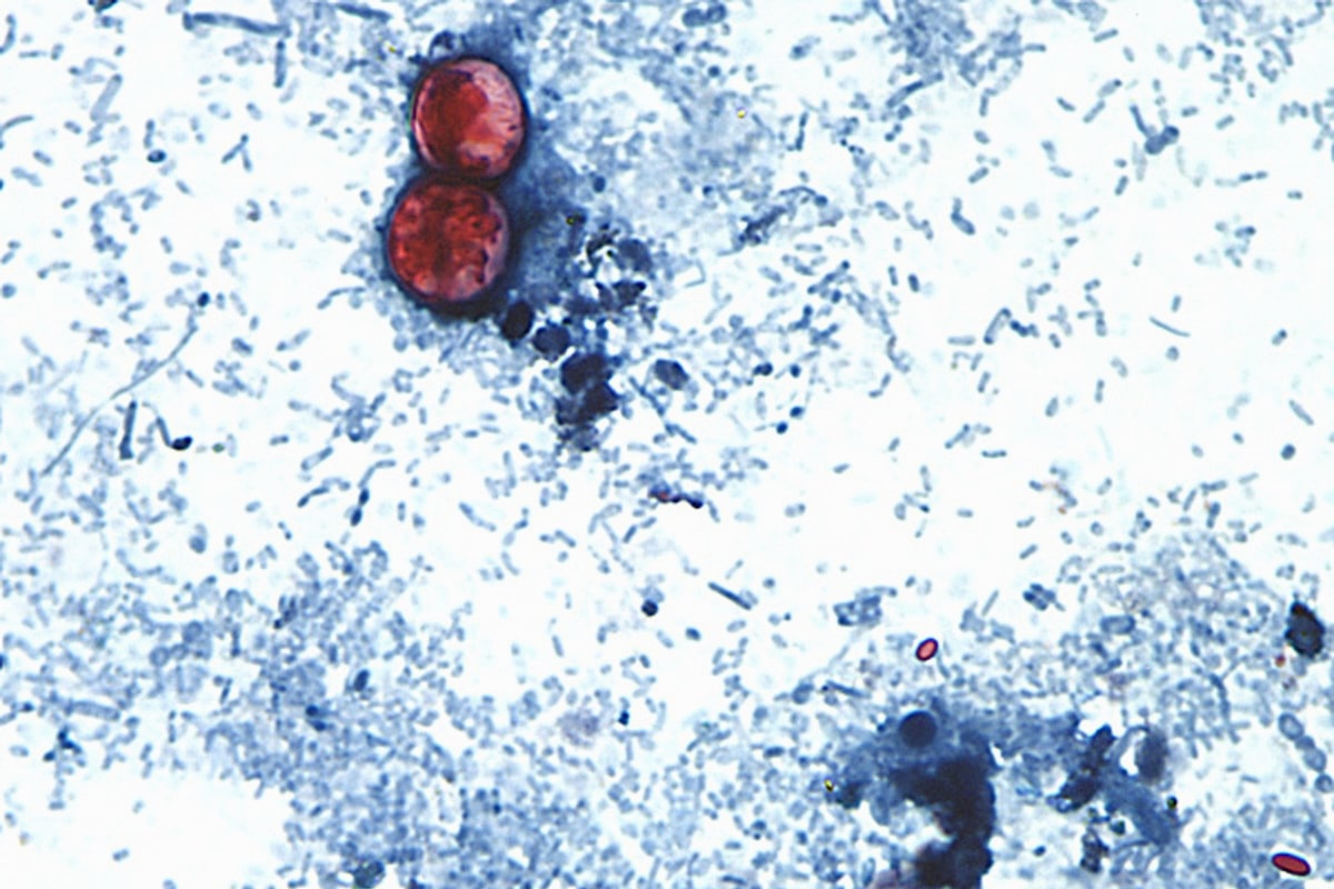 FDA says Taylor Farms cyclospora test result was a false positive